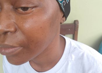 URGENT : S.O.S POUR DAME KADIATOU CAMARA, AGEE DE 39 ANS QUI SOUFFRE DE MENINGIOME DU JUGUM